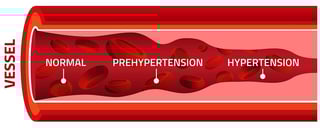 hypertension leads to all kinds of heart problems hypertension leads to all kinds of heart problems