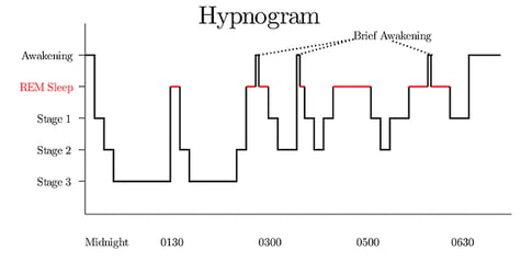 what is sleep architecture