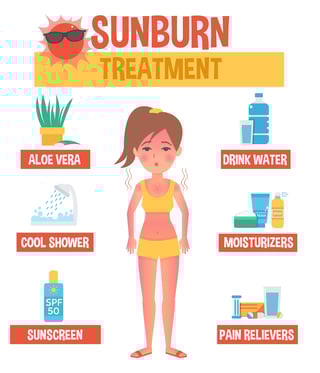 sunburn_treatment