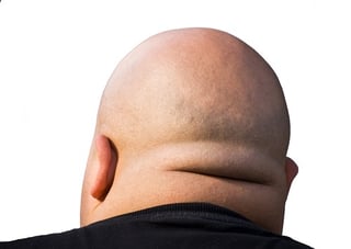 thick_neck_reversed.jpg