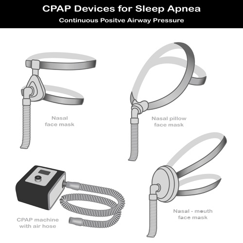 cpap-replacement-supplies-cpa-masks-cpap-tubing-cpap-filters