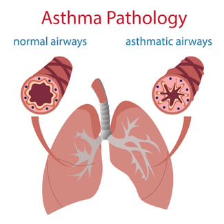 asthma_pathology