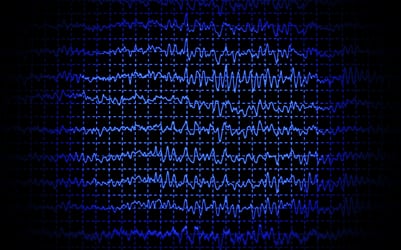 what is a sleep study eeg