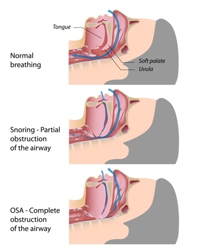 OSA_diagram.jpg