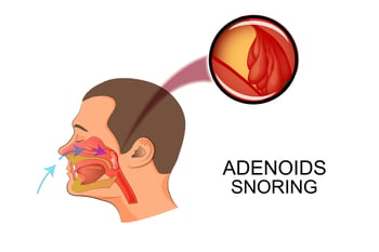 adenoid_snoring_diagram.jpg