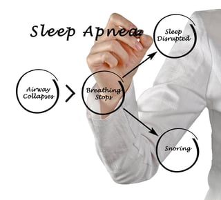 snoring and sleep apnea OSA