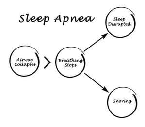 what-is-sleep-apnea