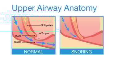 snoring-and-the-upper-airway