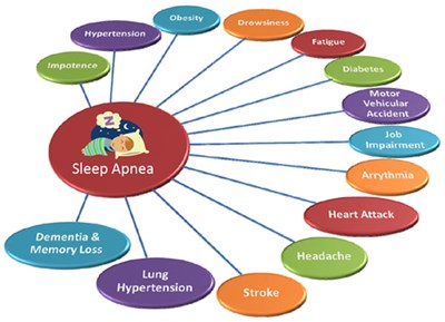 Sleep Apnea